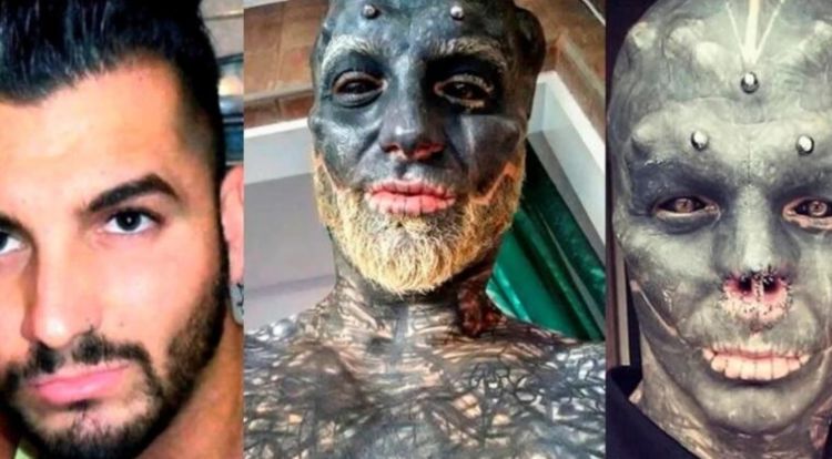 Quiere ser un alien: ya se quitó nariz y orejas y ahora se amputará una pierna