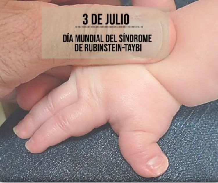 03 de julio: Día Internacional del Síndrome de Rubinstein-Taybi