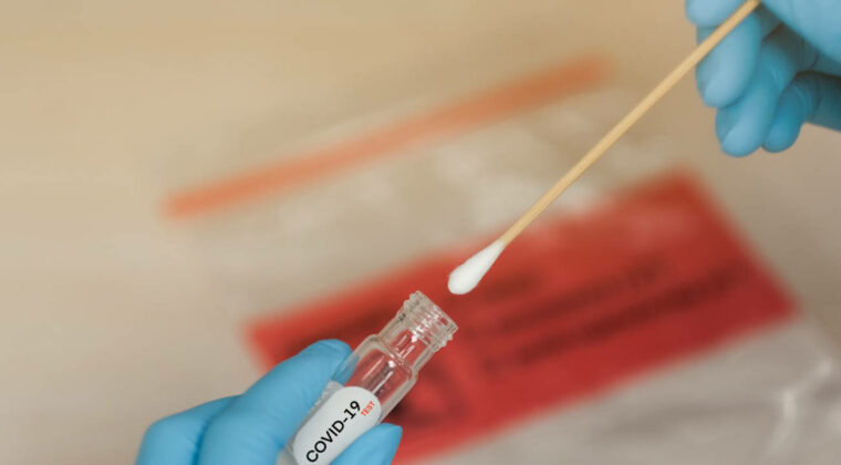  Salud reporta semana sin fallecidos por COVID-19